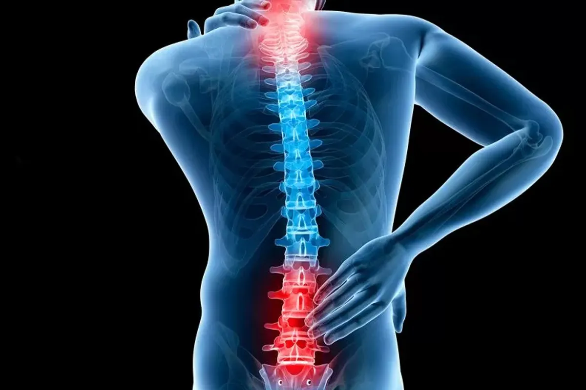 دیسک کمر و ورزشهای مناسب برای مدیریت آن